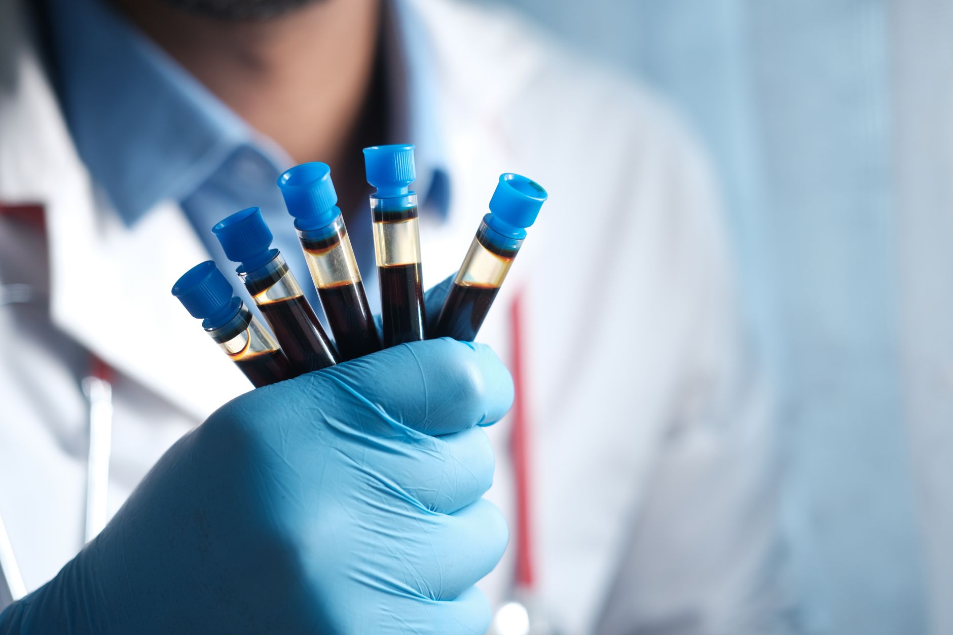 Profissional de saúde com luva azul segura tubos de coleta de sangue em laboratório de análises clínicas
